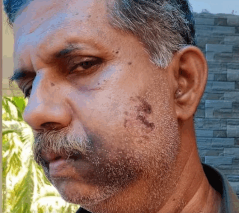 Kerala school rivalry news in Hindi