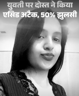 Jabalpur - ‘सरप्राइज’ के नाम पर सहेली ने बुलाया, तेजाब फेंककर झुलसा दिया चेहरा