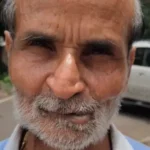 जबलपुर: मुंह के छाले की सर्जरी के बाद मुंह के अंदर उगने लगे बाल, मरीज ने डॉक्टर पर लापरवाही का लगाया आरोप