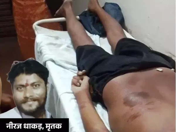 Bhopal News: जेल पहुंचने के दो दिन बाद बंदी की मौत, पुलिस पर मारपीट का आरोप; चोरी के केस में हुई थी गिरफ्तारी