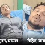 वाराणसी एयरपोर्ट पर लाइसेंसी पिस्टल से चली गोली, महिला समेत 2 कर्मचारी घायल