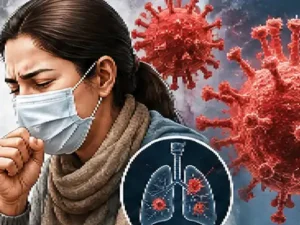 Swine Flu in Bhopal: 12 दिन में 45 मरीज, पहली मौत; कुल केस 65 पहुंचे