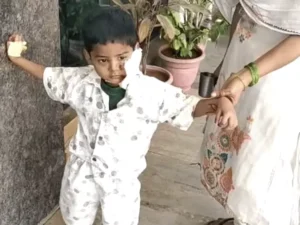 Gwalior Dog Attack: आवारा कुत्ते ने बच्चे पर किया हमला, चेहरे पर चोट; सामान लेने निकला था मासूम