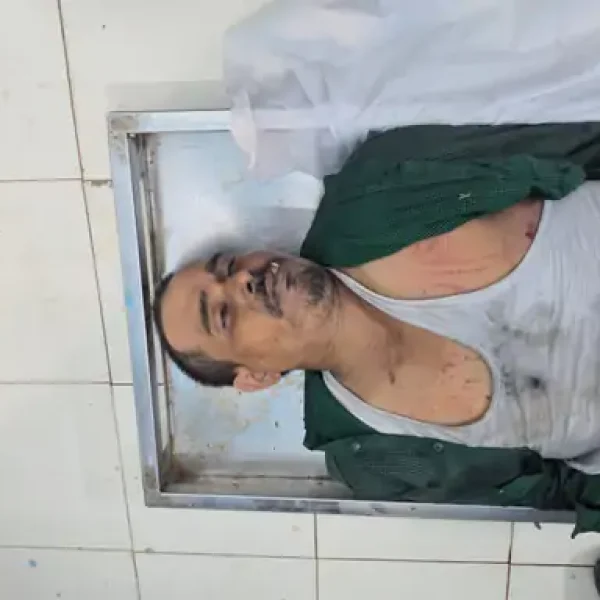 बिलासपुर की फैक्ट्री में दर्दनाक हादसा, लोडर की चपेट में आने से कर्मचारी की मौत