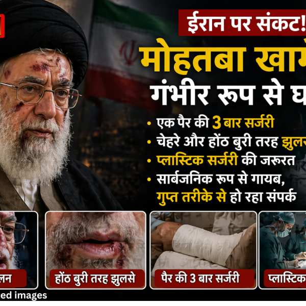 Mojtaba Khamenei injured, Iran Supreme Leader health update, plastic surgery face burn Iran, US Iran war news, Mojtaba Khamenei condition