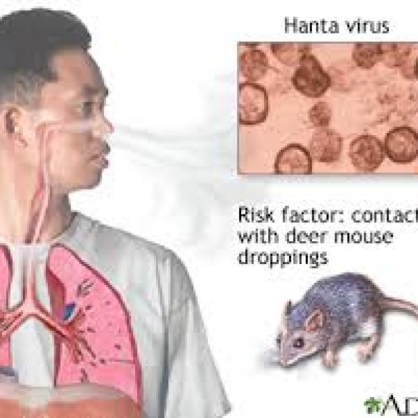 Hantavirus