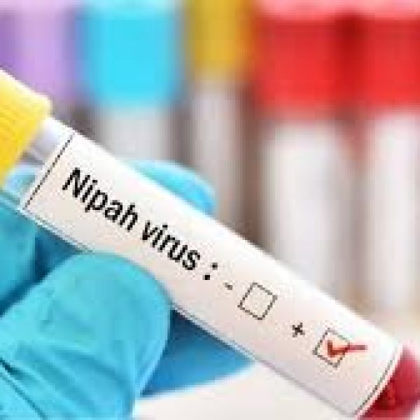 Nipah Virus