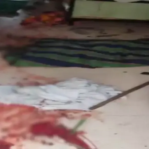 बिलासपुर में पानी भरने के विवाद में ऑटो चालक पर कुल्हाड़ी से हमला, हालत गंभीर